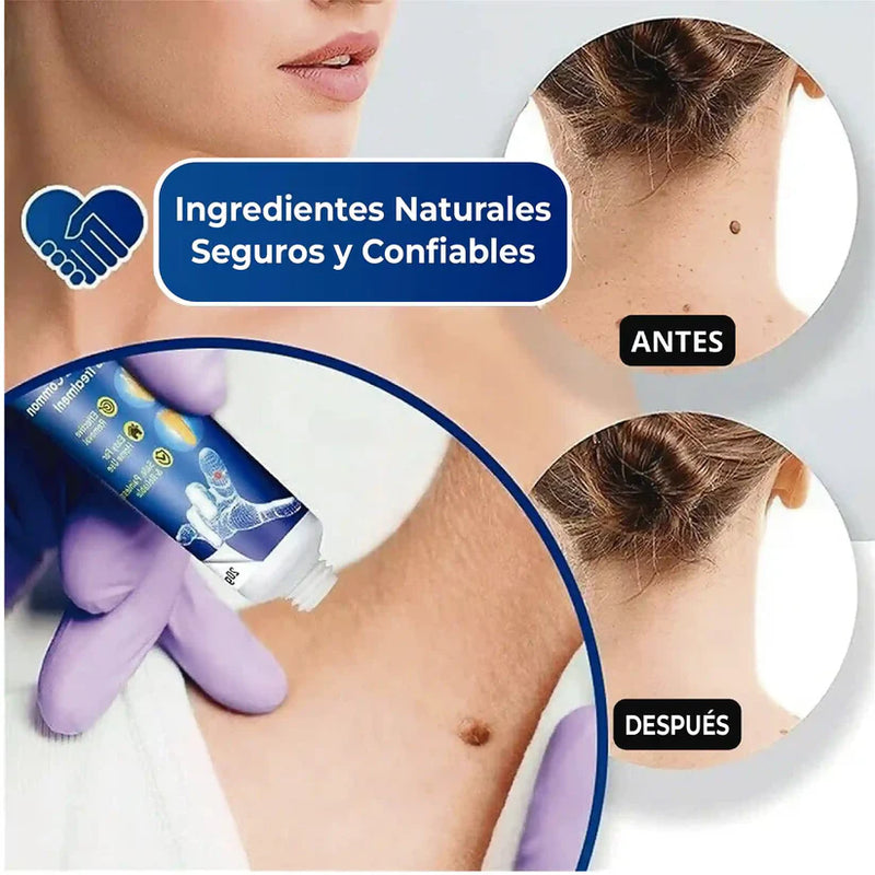 2x1 Crema + Sérum ELIMINADOR DE VERRUGAS